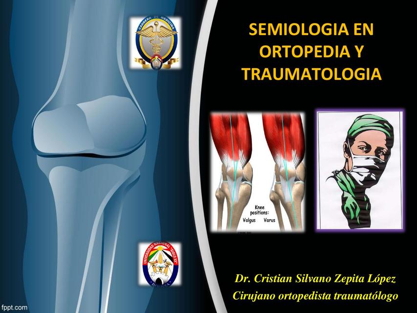 Semiologia en ortopedia y traumatología  