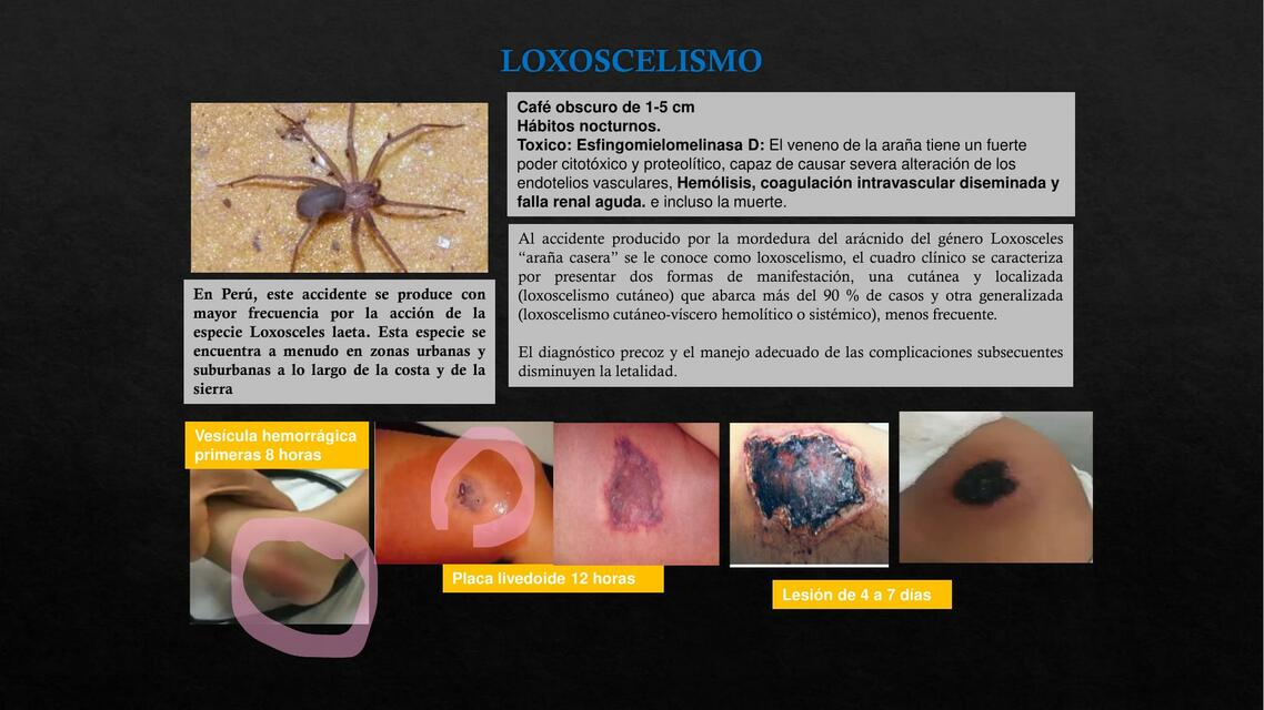 loxoscelismo-nursing-apuntes-udocz