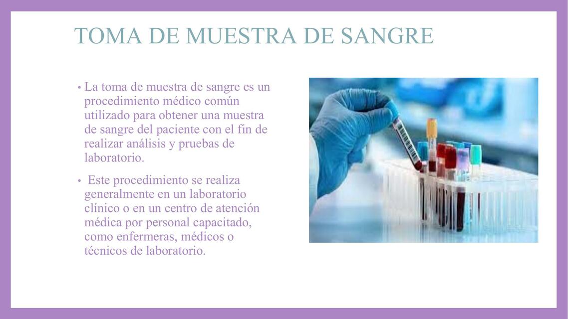 Toma de Muestra de Sangre 