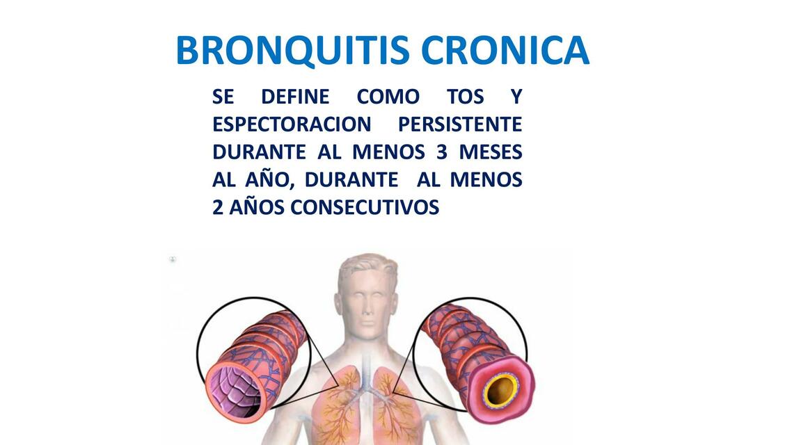 BRONQUITIS CRONICA