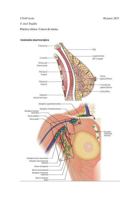 Factores modificables/no modificables/protectores de Cáncer de Mama