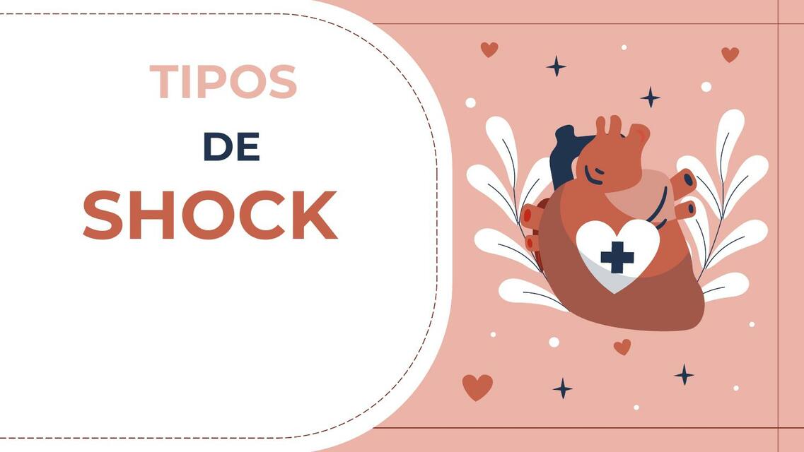 TIPOS DE SHOCK UCI