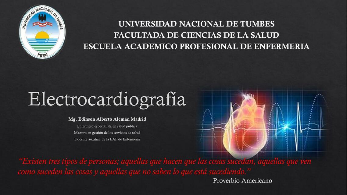 Electrocardiograma