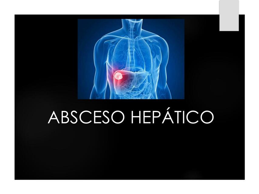 Absceso hepático