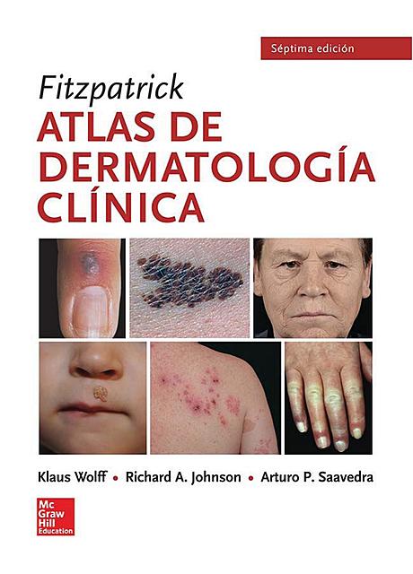 Fitzpatrick Atlas de dermatología clínica de Wolff K, Johnson R y Saavedra A