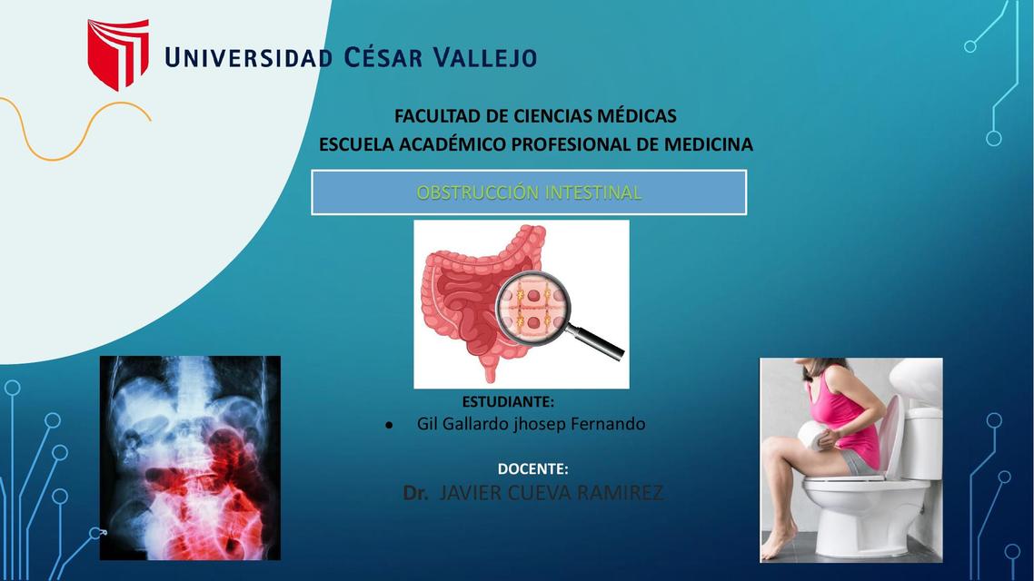 Fisiopatologia de obstrucción