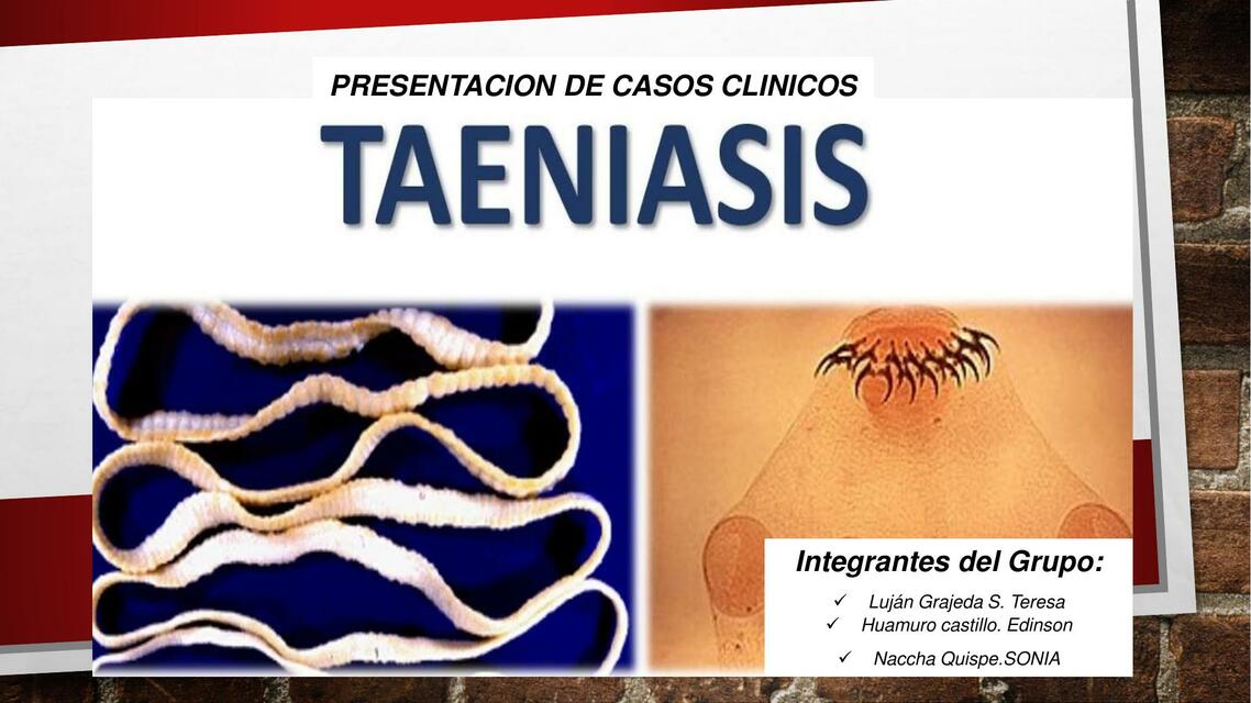 Taeniasis 