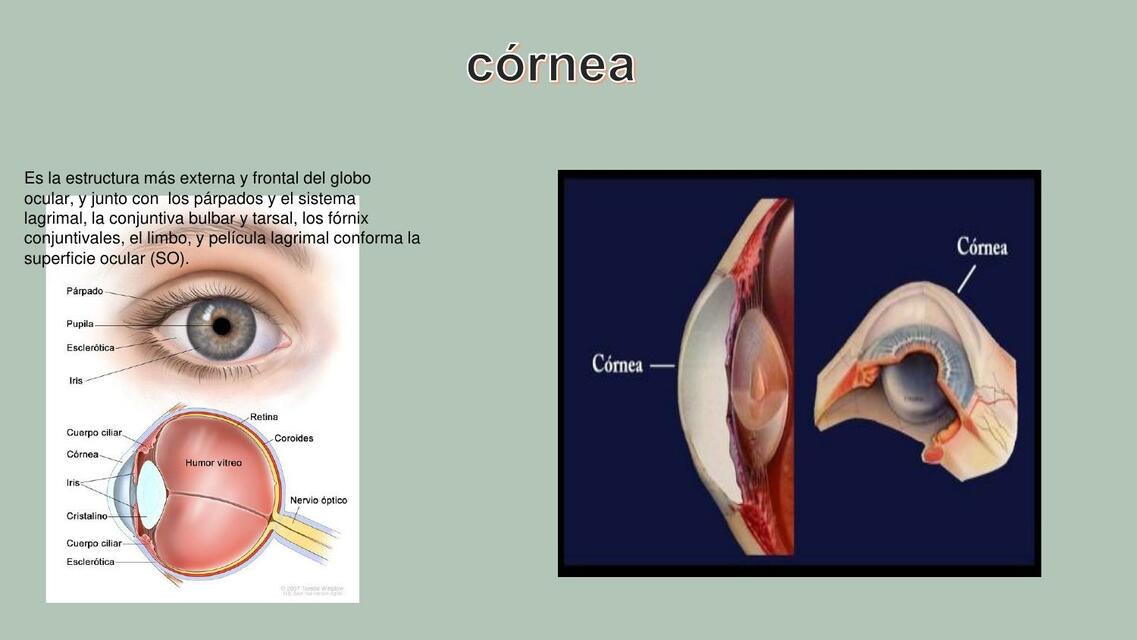 ojo queratitis