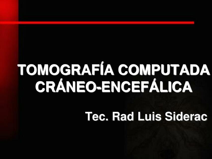 TOMOGRAFIA COMPUTADA CRANEO