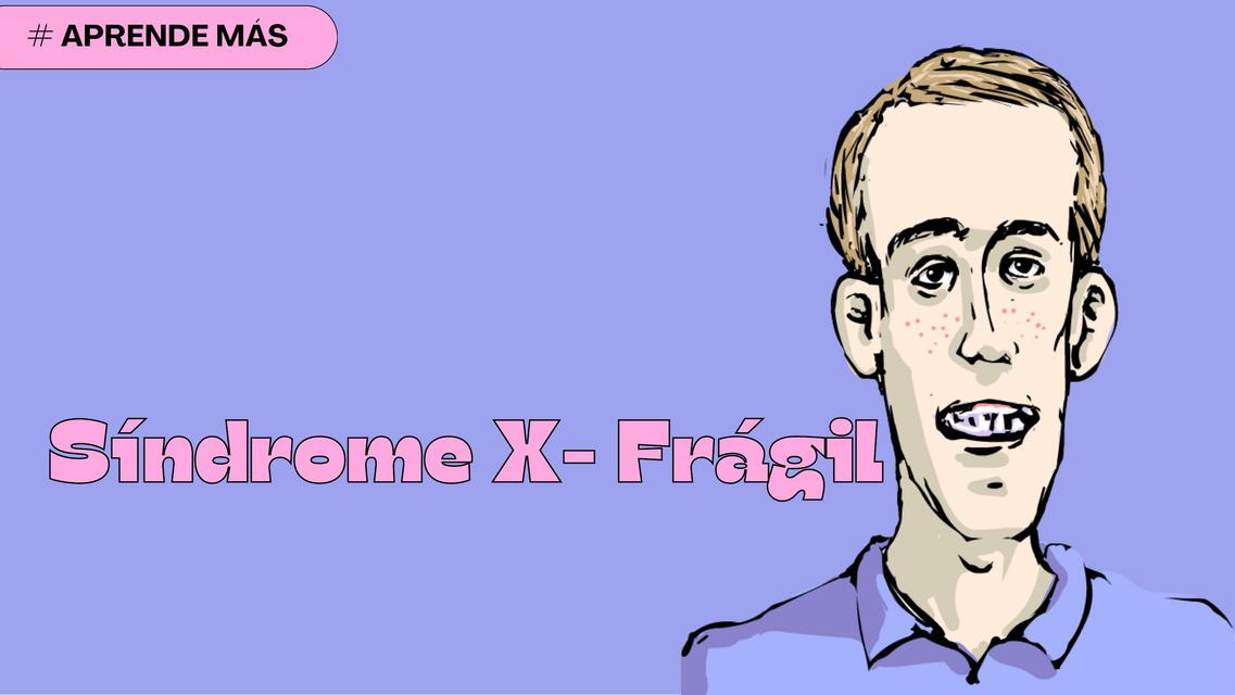 Síndrome X-Frágil