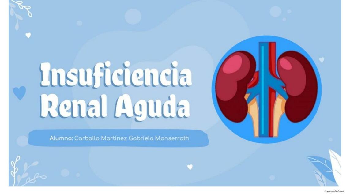 Insuficiencia renal aguda