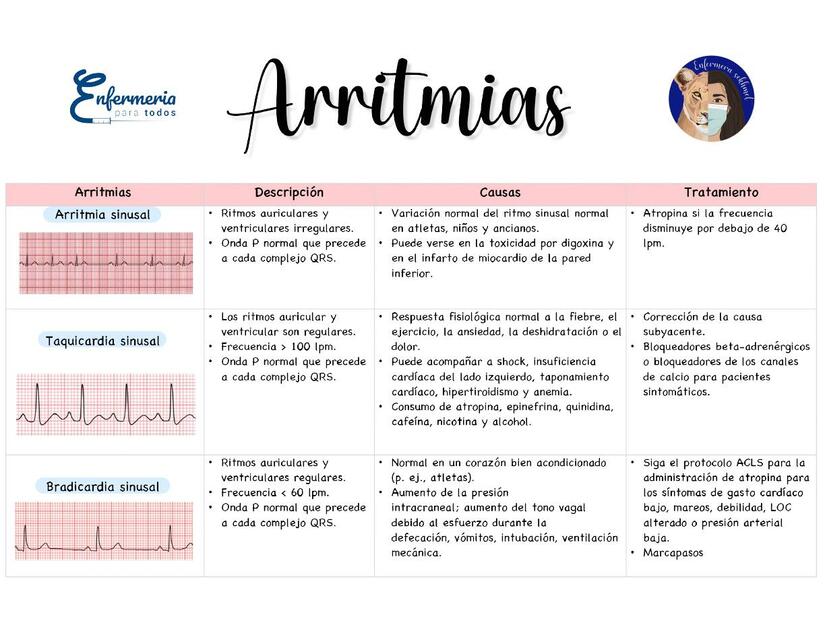 Arritmias 1 Jysus Valcazar Udocz Arritmias 1 Jysus Valcazar Udocz