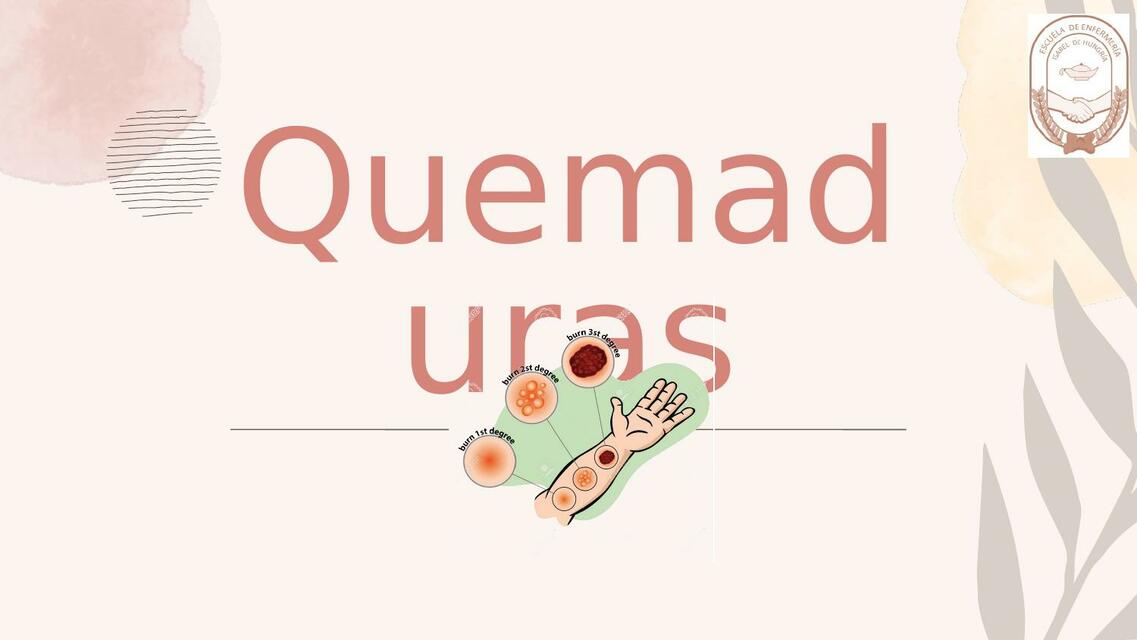 QUEMADURAS