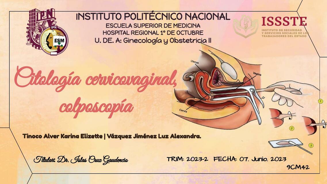 Citología cervicovaginal colposcopía