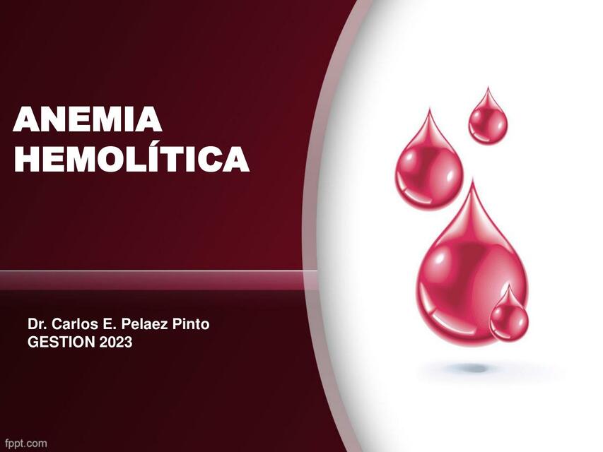 Anemia Hemolítica 