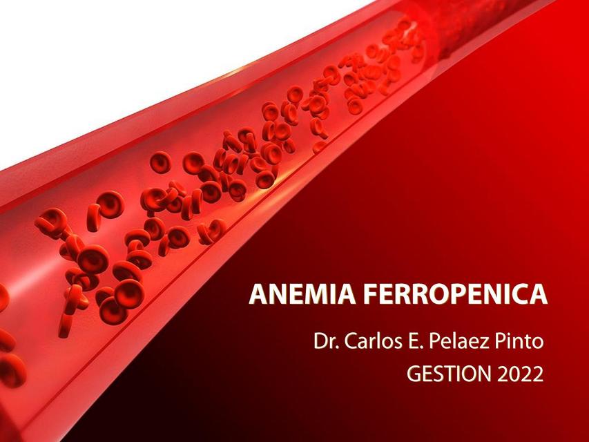 Anemia ferropénica  