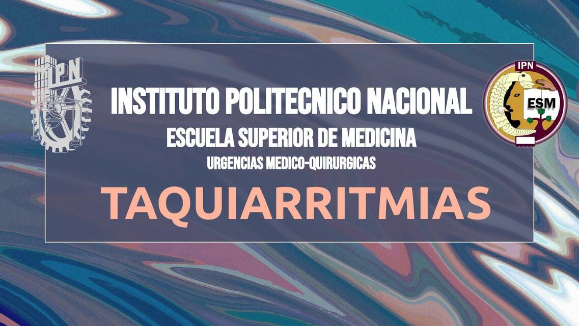 Taquiarritmias