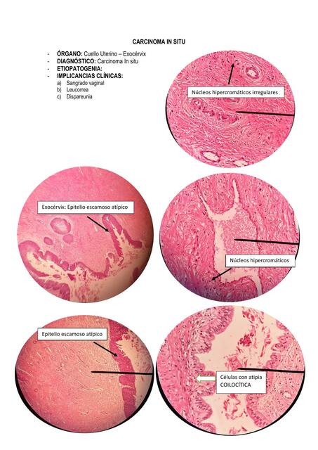 Laminas  De Patología  Genital  Femenino - Osteomuscular  y LINFOHEMATOLÓGICa 