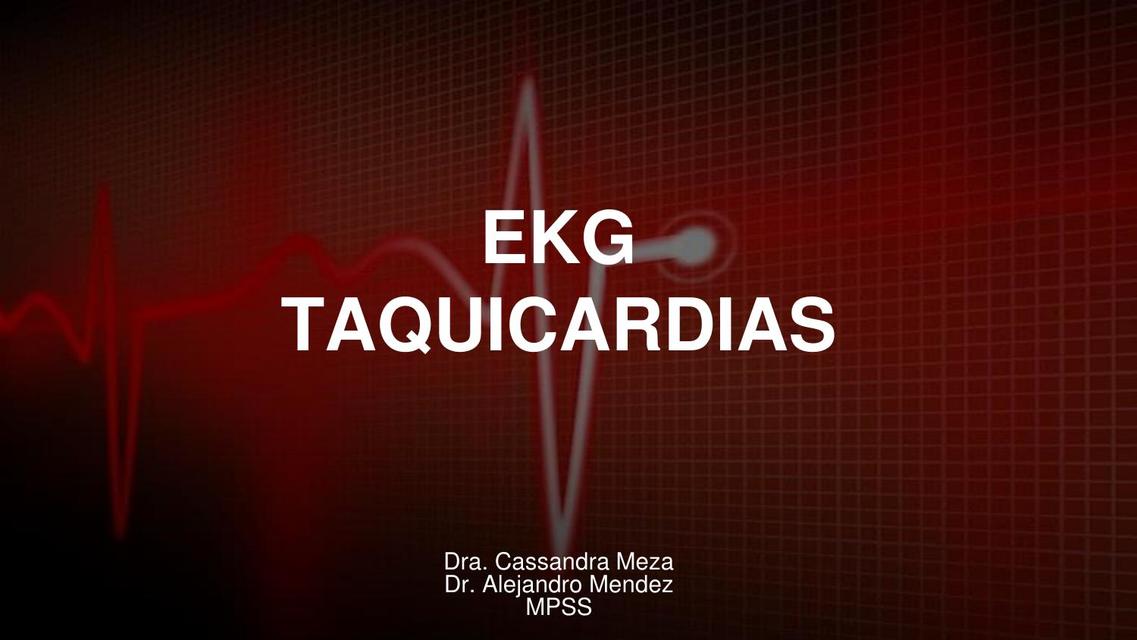 EKG Taquicardias 