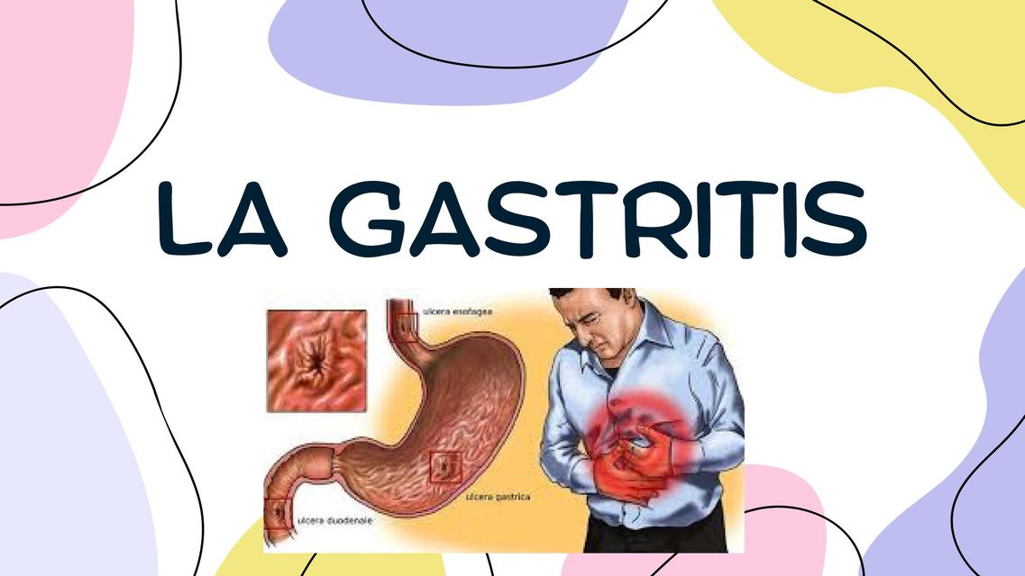 La gastritis 