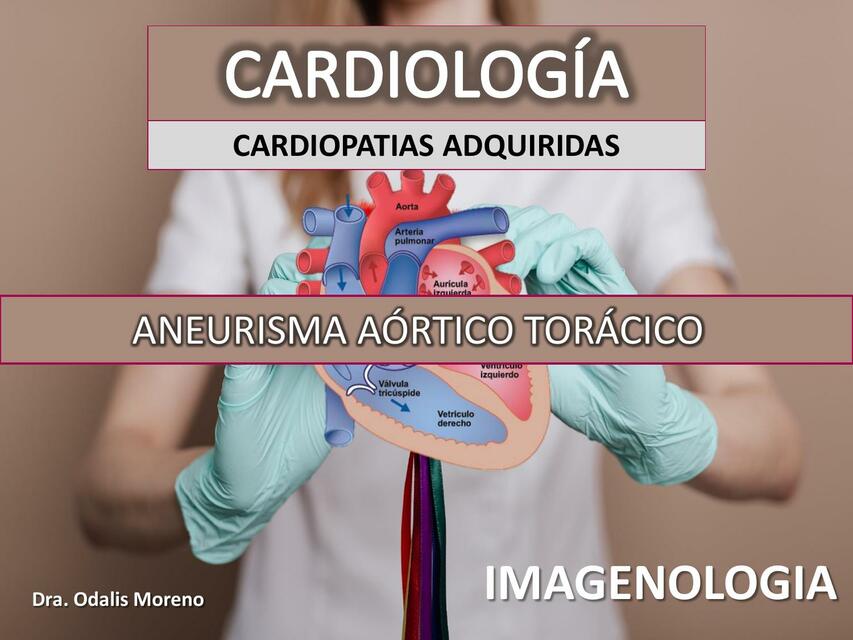 Aneurismas Aórticos Torácicos _ Aneurismas de la aorta torácica – QNBR
