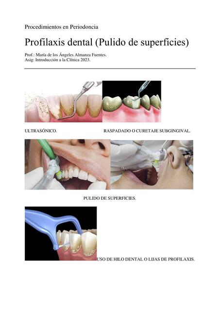 Procedimientos en Periodoncia