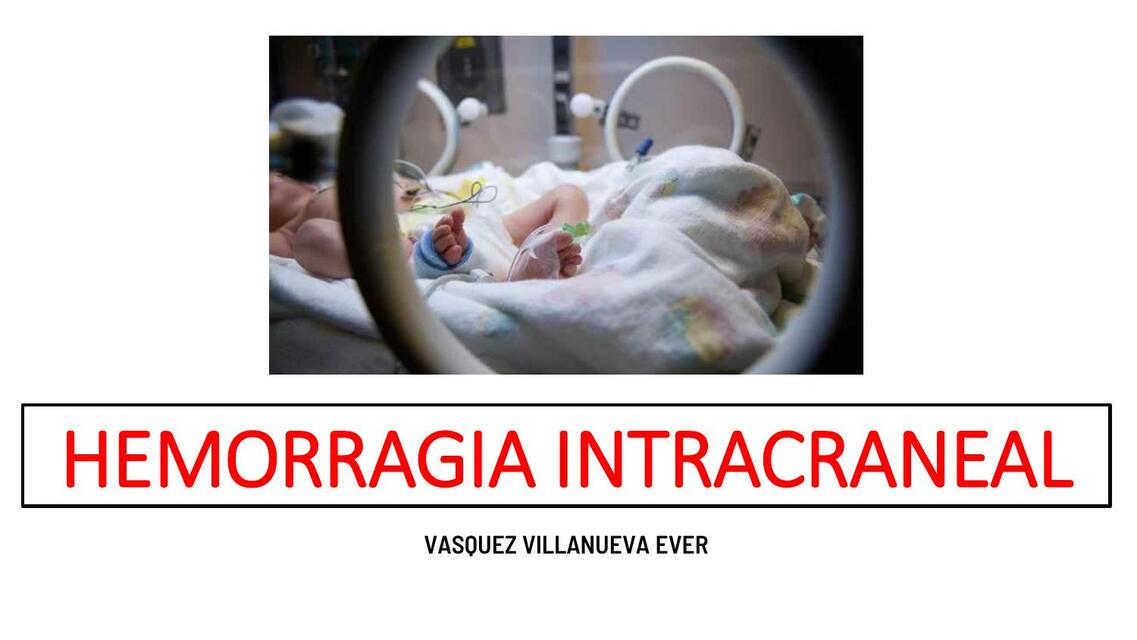 Hemorragia Intracraneal 