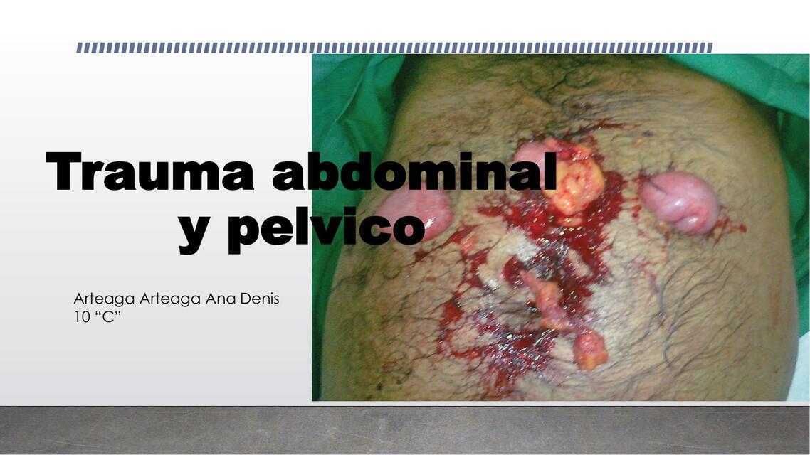 Trauma Abdominal y Pélvico 