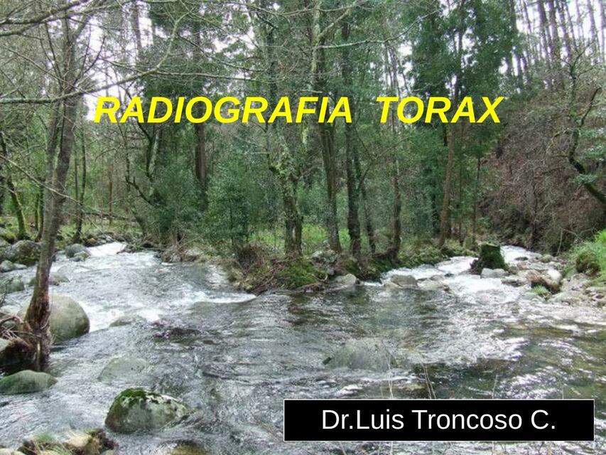 Radiografía de Tórax 