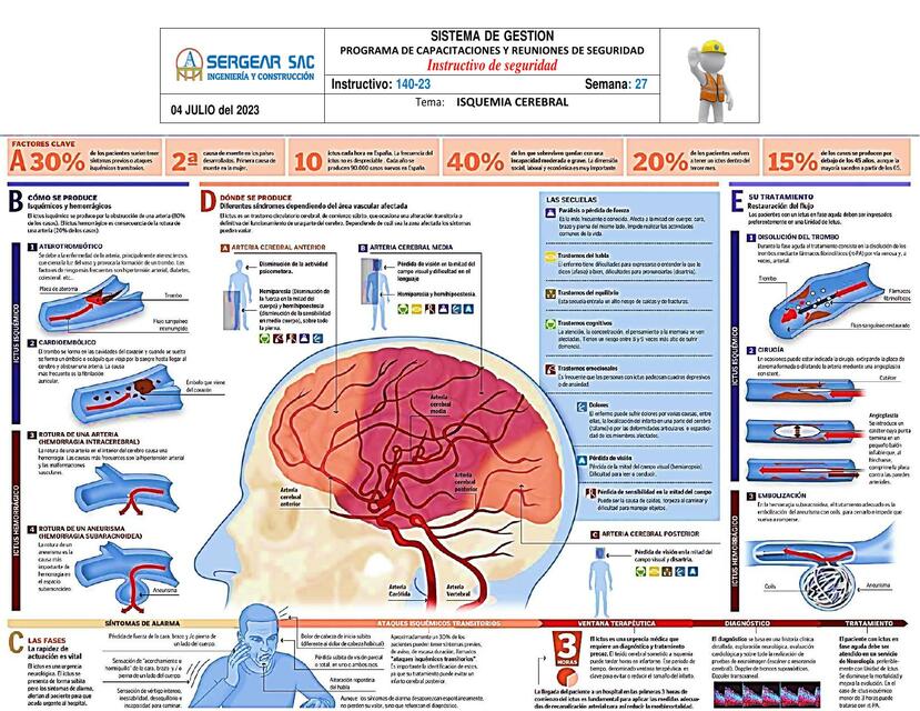 Isquemia Cerebral