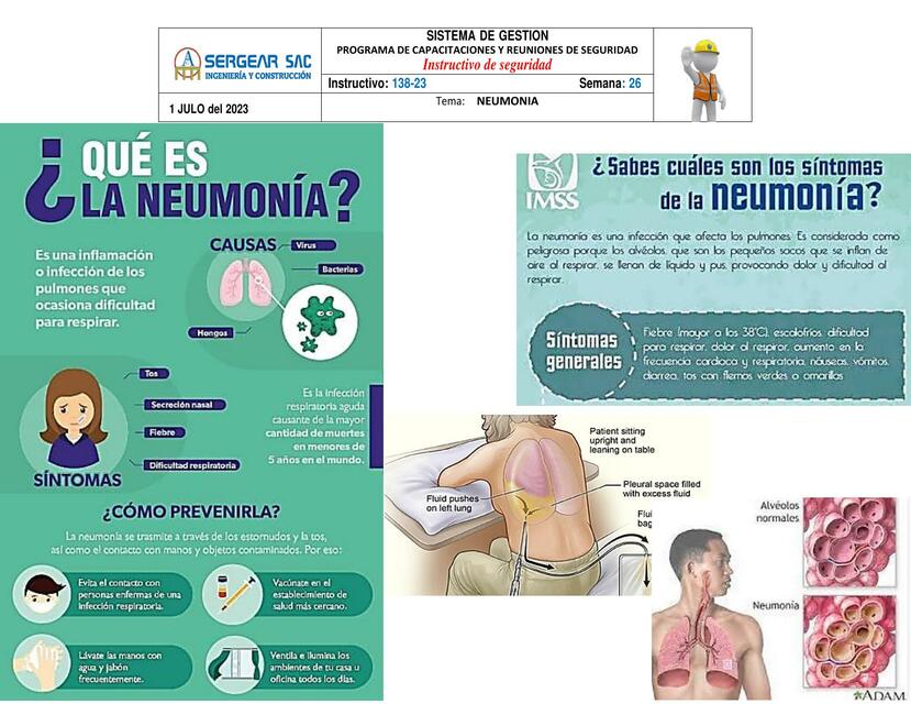 Neumonía