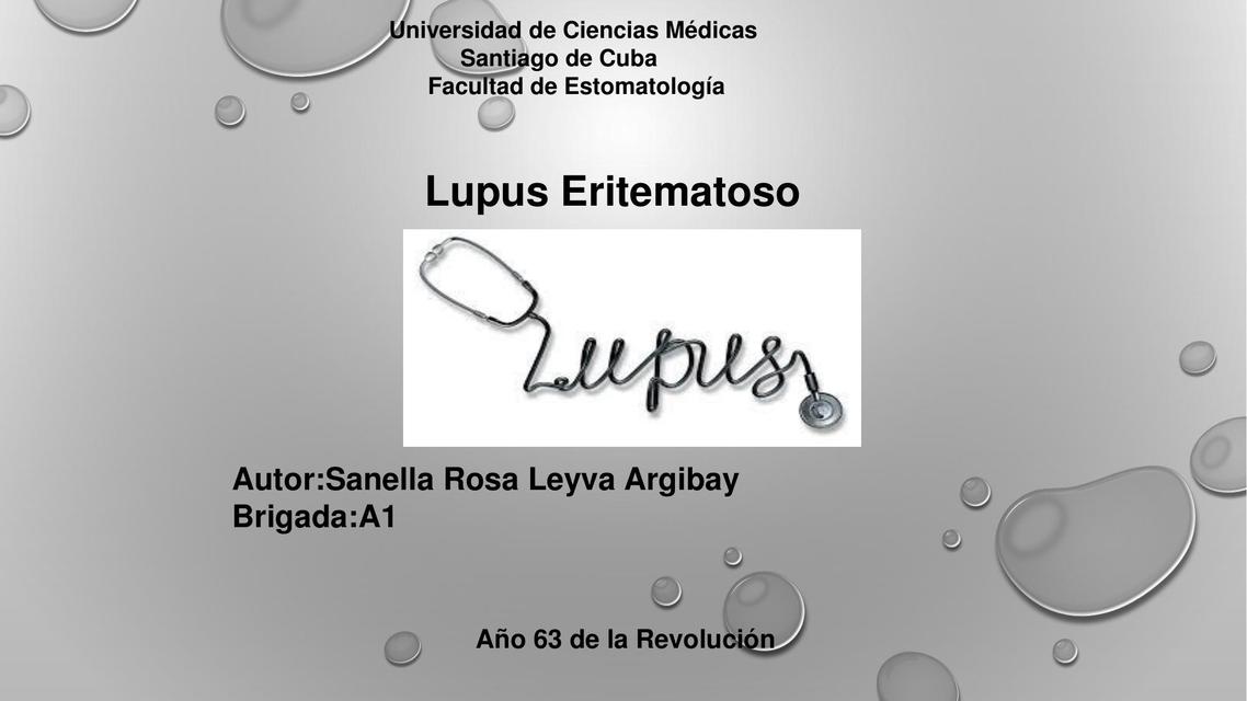 Lupus eritematoso 