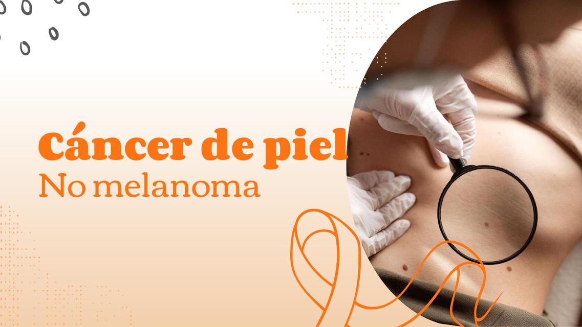 Cancer de piel no melanoma 