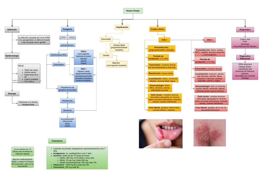 Herpes Simple 