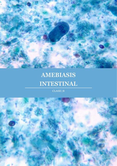 Amebiasis intestinal