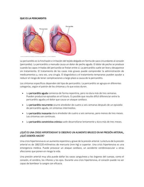 Que es la pericarditis 