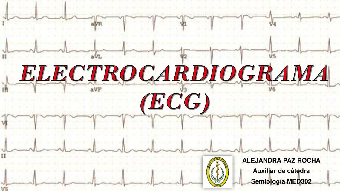 Electrocardiograma