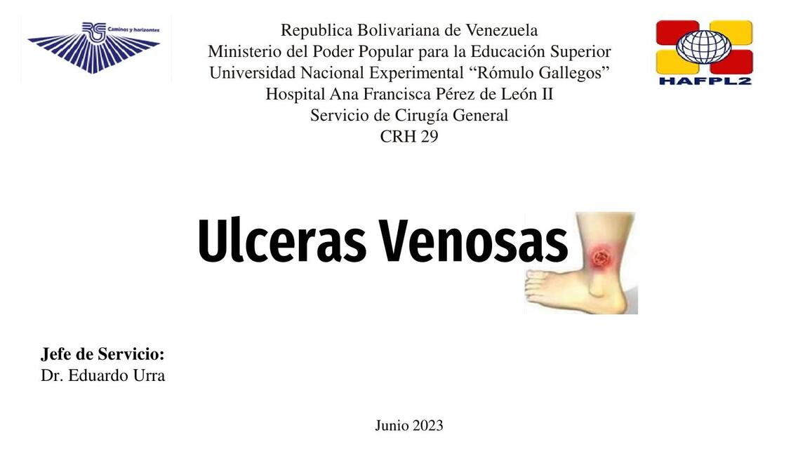 Úlceras venosas 