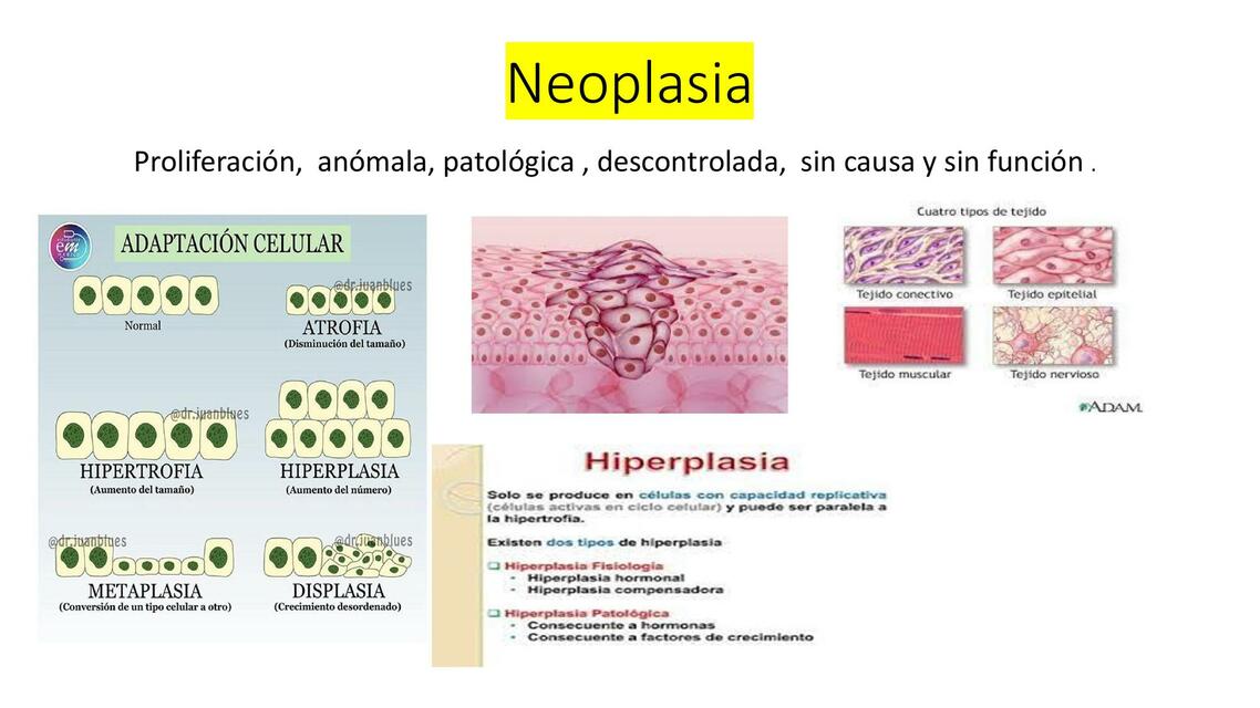 Neoplasia 