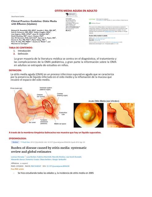 Otitis media aguda en adulto 