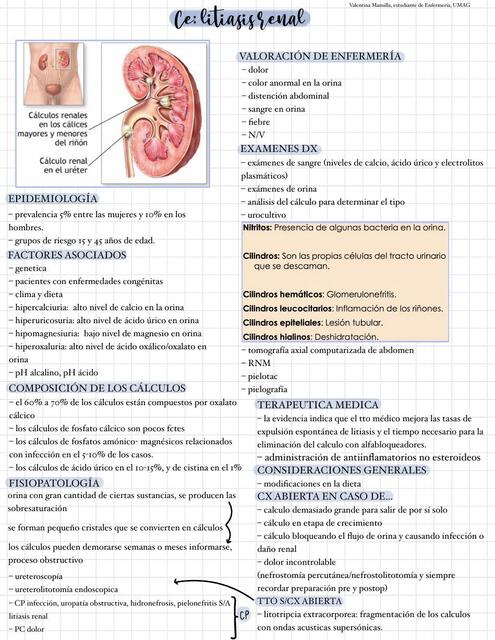 Litiasis Renal