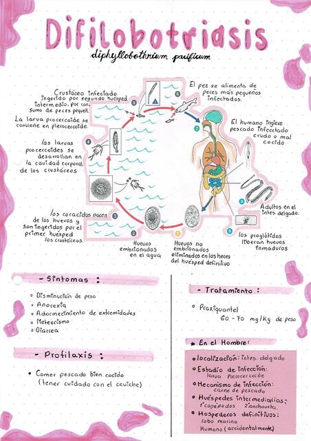 Difilobotriasis