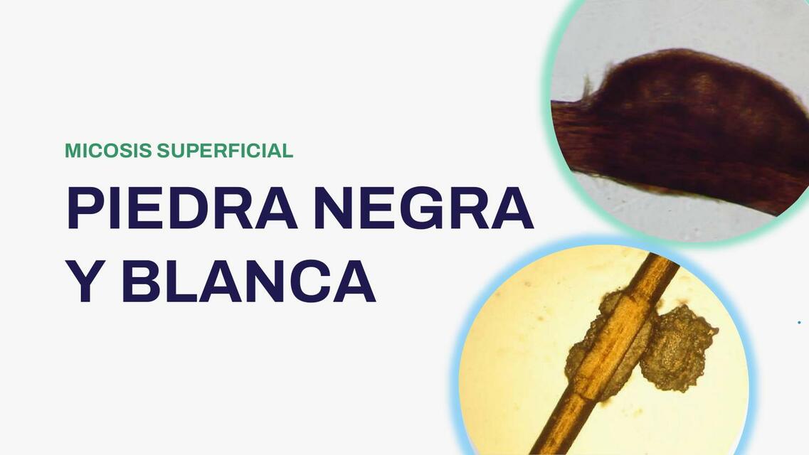 Piedra Negra y Blanca 