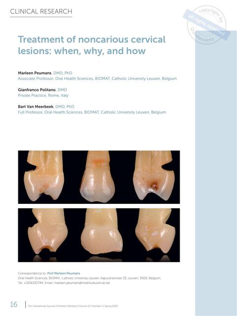 Tratamiento de lesiones cervicales no cariosas 