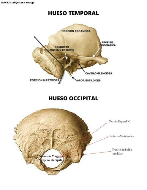 Hueso Temporal 