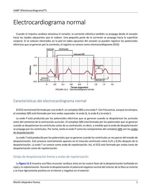 Electrocardiograma Normal 