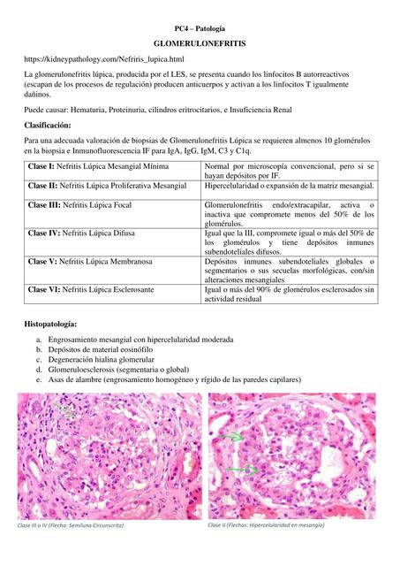 Glomerulonefritis 