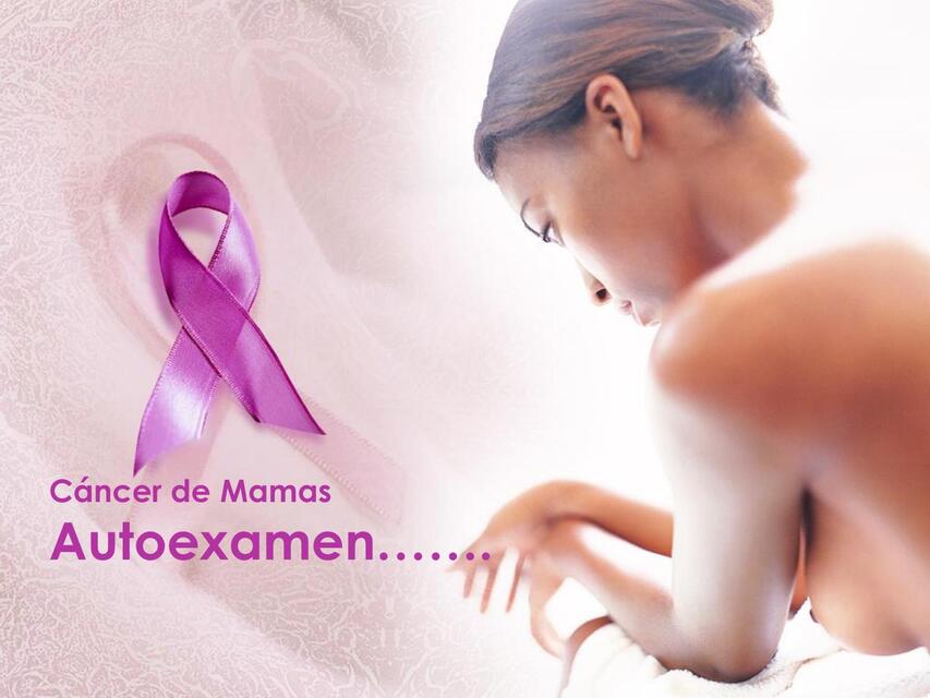 Caso N 4 Prevencion cancer de mamas  