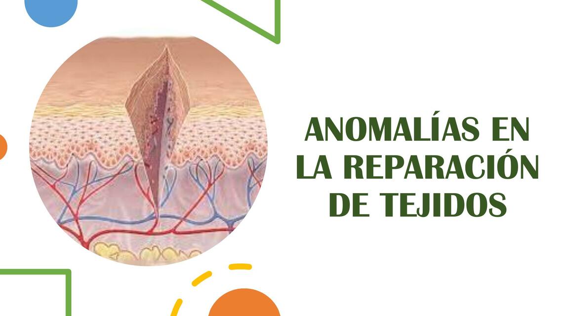 Anomalías en la Reparación de Tejidos