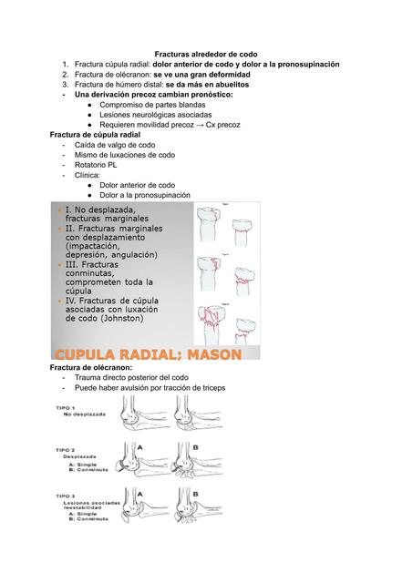 Fractura al rededor de codo